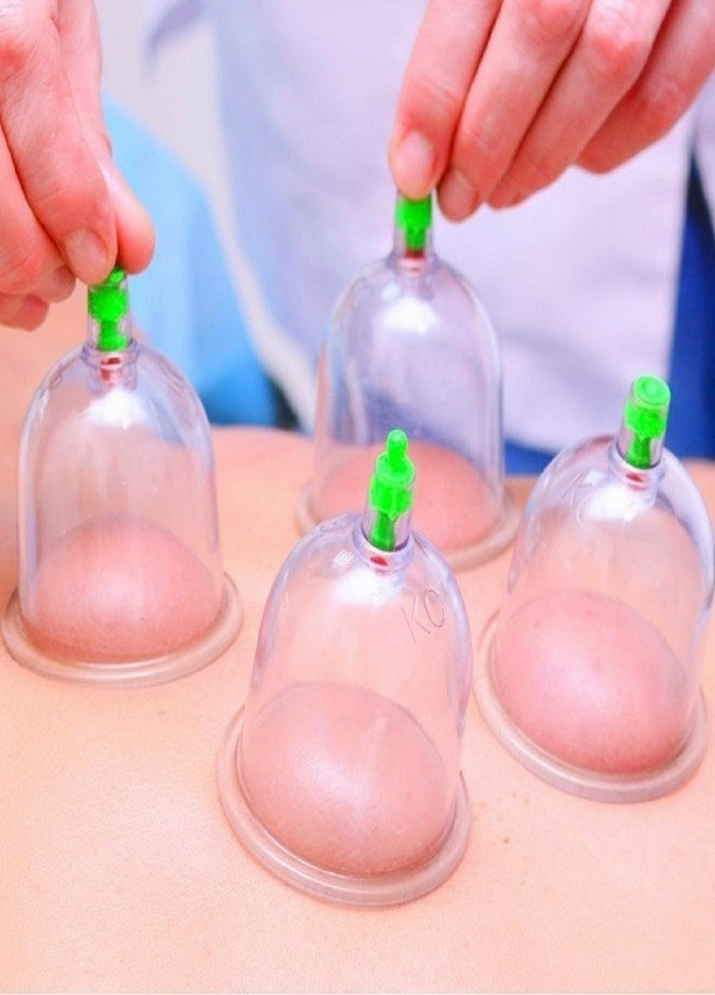 Вакуумний масажер KL PULL OUT A VACUUM APPARATUS Forus (253319227)