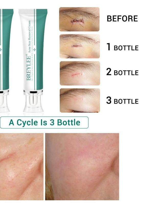 BREYLEE Крем для лица и тела восстанавливающий от рубцов и шрамов 30г (0199) — Крем, Бельгия (252548798)
