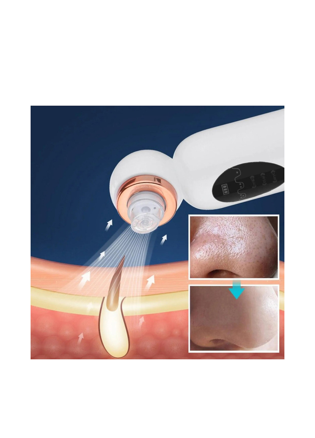 Інструмент для чищення обличчя TV-magazin (294609934)