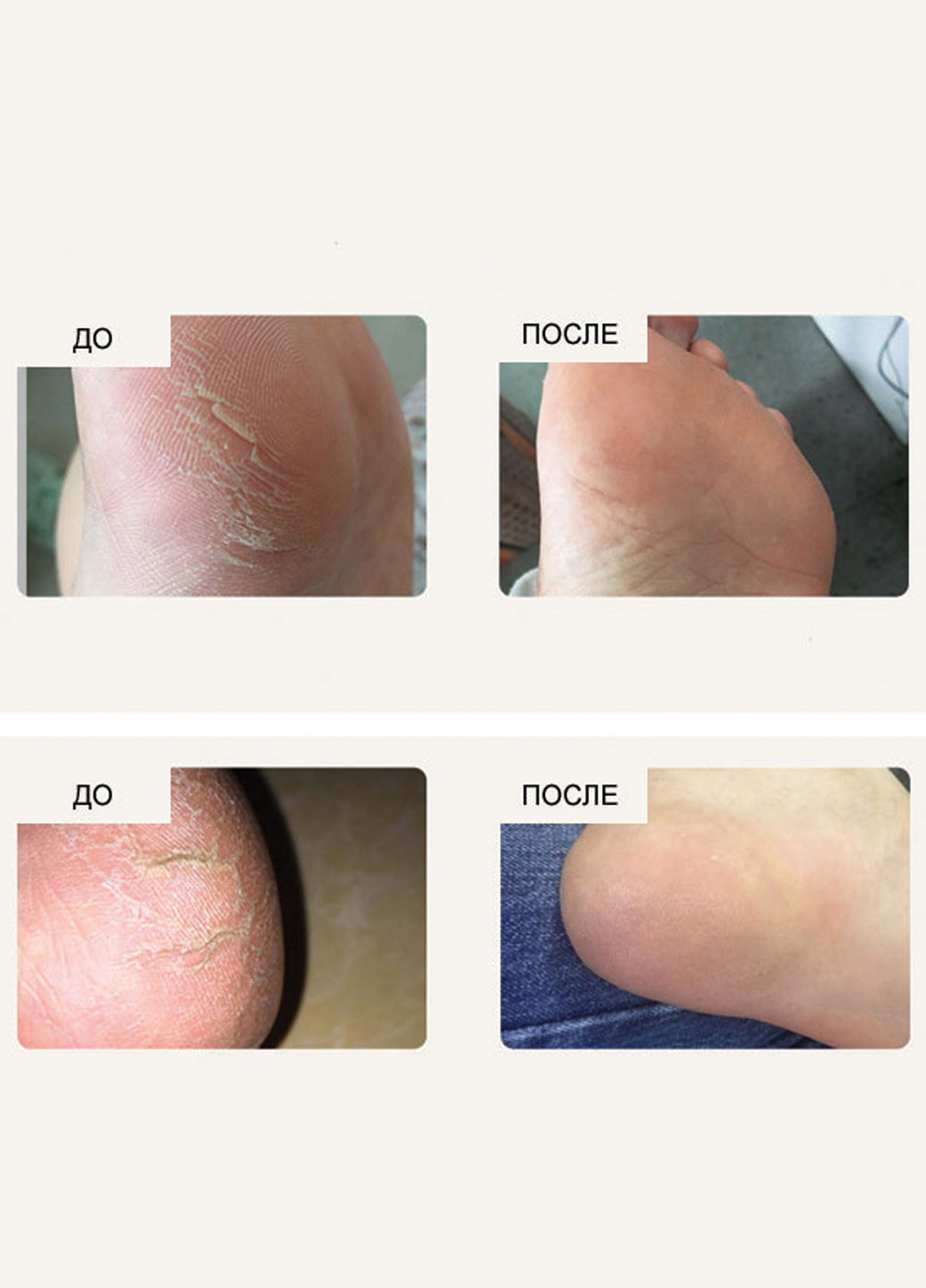 Bioaqua Заживляющий крем с конским жиром Ointment 80г(0164) — Крем, Китай (252548827)