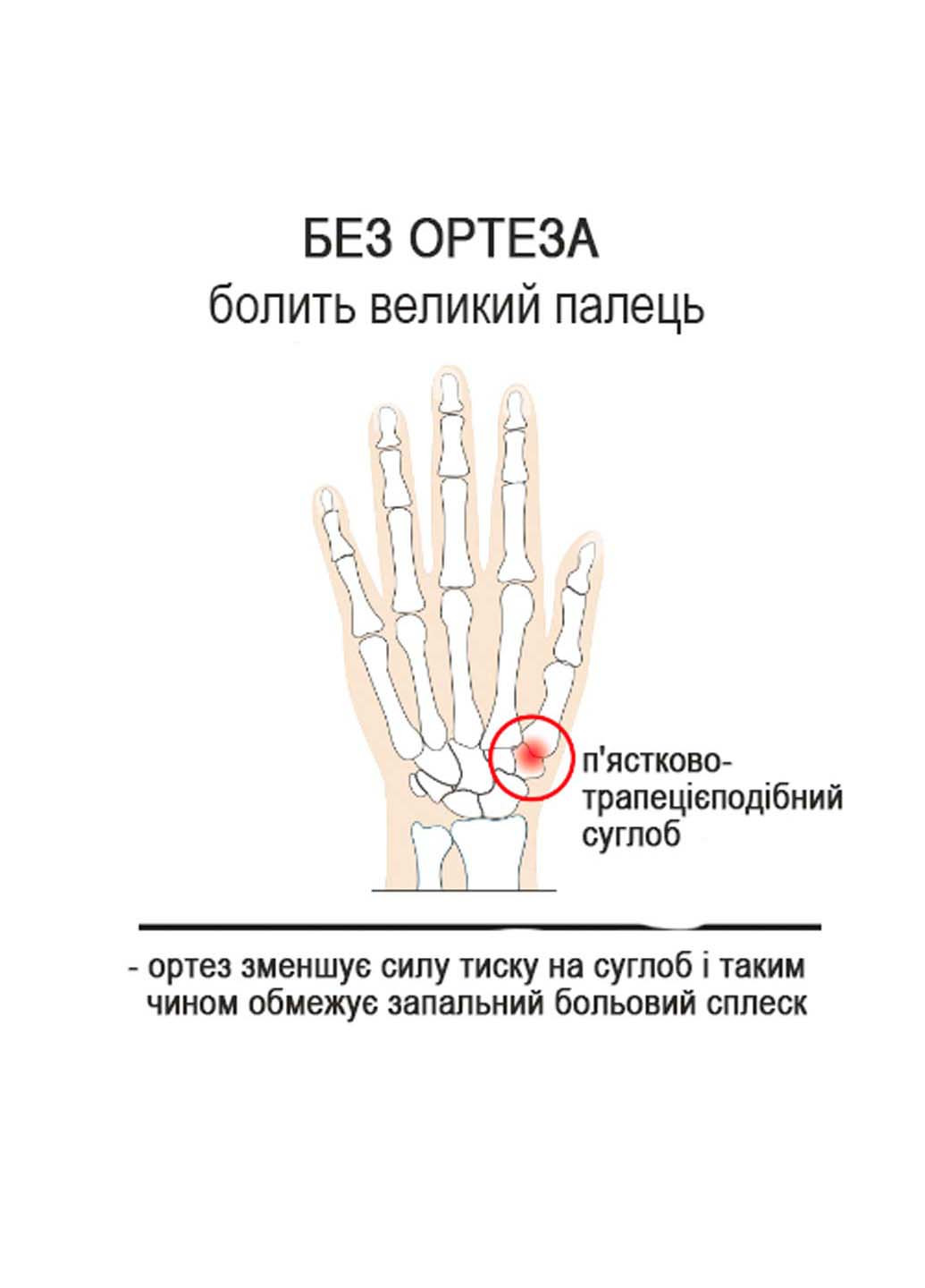 Ортез великого пальця правої руки гнучкий день EP592DX2 М Epitact (276976544)