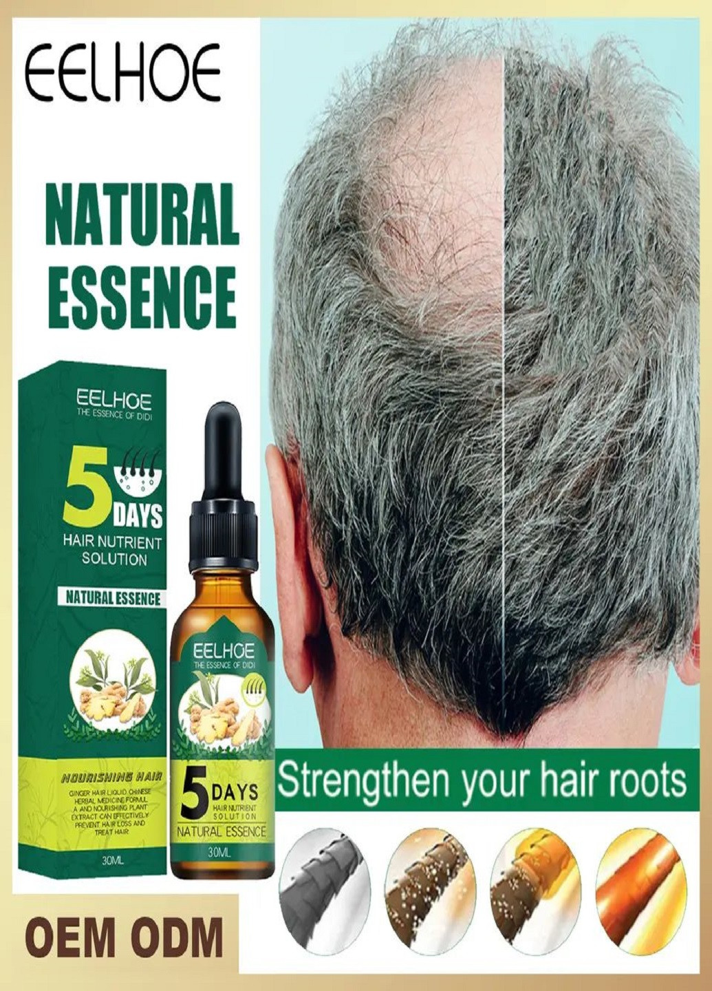 Имбирное масло для роста и выпадения волос EELHOE 5 DAYS 30 мл No Brand (264070982)