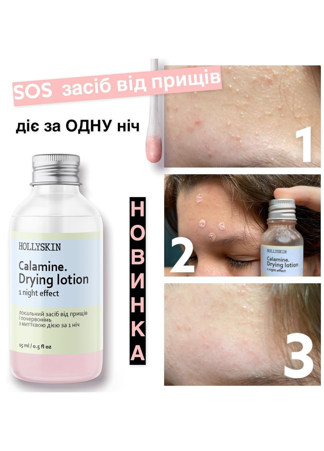 Набор для борьбы с сыпями, черными точками и пятнами на лице Calamine + Salicylic Acid (50 г + 15 мл +30 г) Hollyskin (260118878)