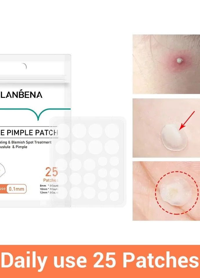 Патчи от прыщей дневные Acne Pimple Patch Night Use (25 шт) LANBENA (260476740)