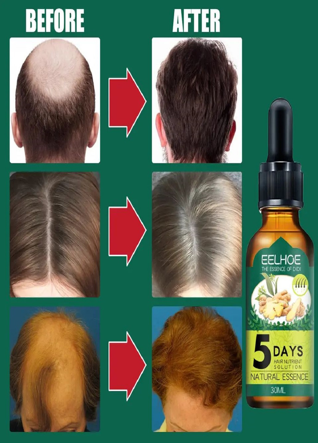 Імбирне масло для росту та від випадіння волосся EELHOE 5 DAYS 30 мл No Brand (264070982)