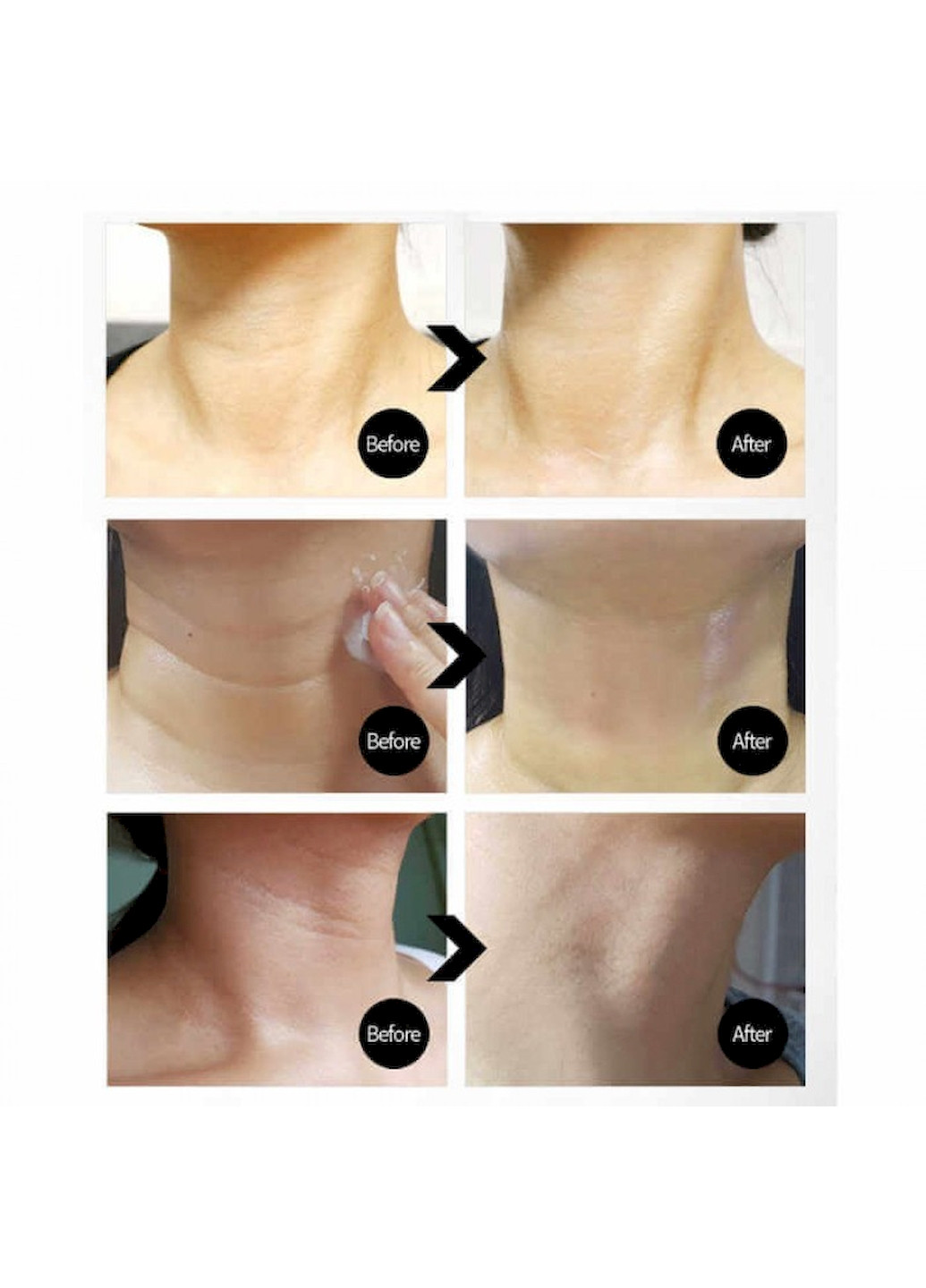 Medi Peel Подтягивающий крем для шеи PREMIUM COLLAGEN NAITE THREAD NECK CREAM 2.0 с пептидным комплексом, 100 мл — Крем, Южная Корея (262301166)