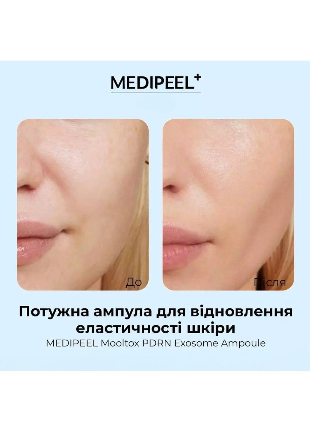 Medi-Peel Сыворотка для восстановления эластичности кожи Mooltox pdrn Exosome Ampoule 50 мл — Крем, Южная Корея (368395261)