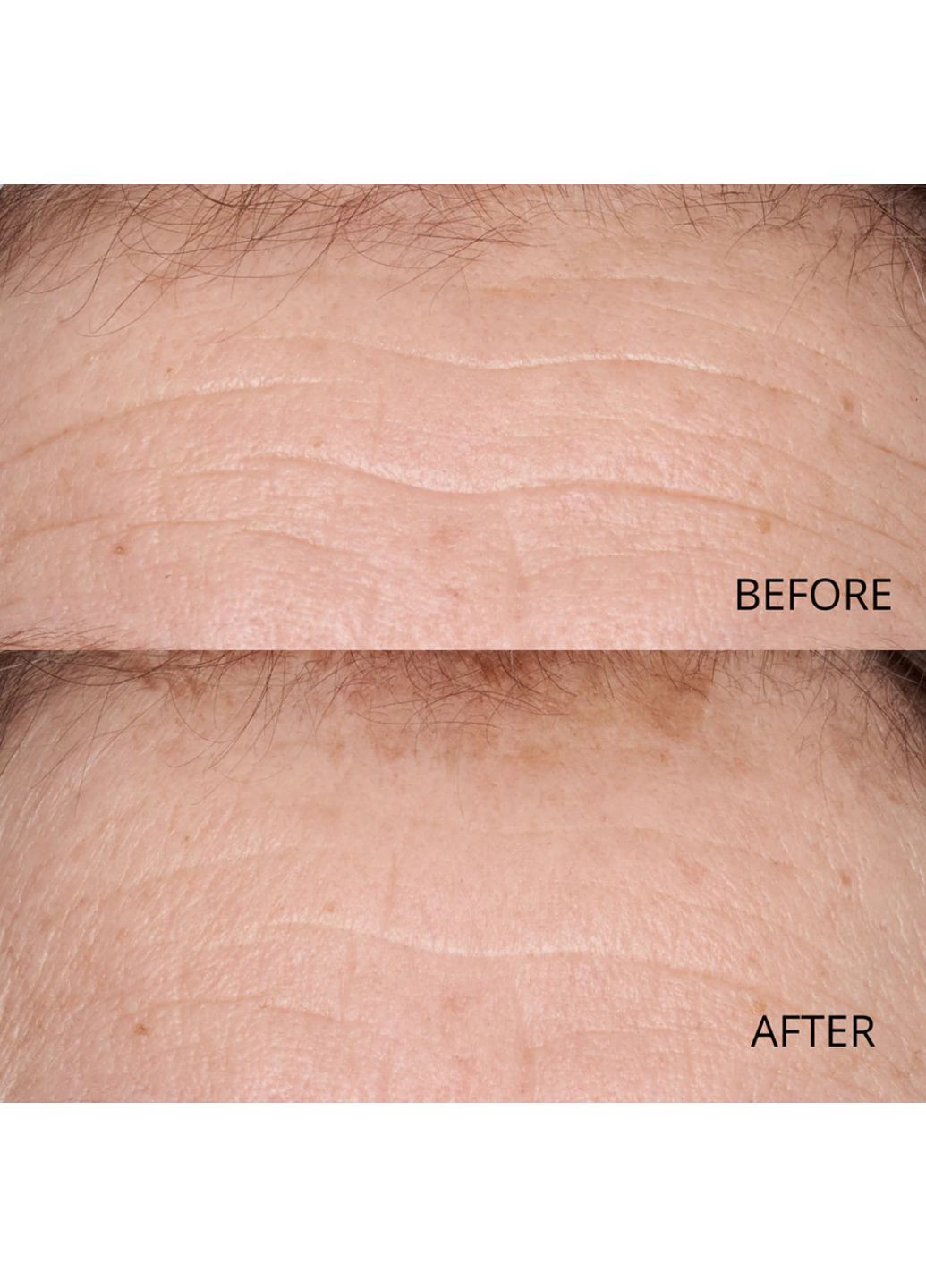 Сироватка для шкарпеток, що вирізняє Hypoallergenic Clean Correction Smoothing Restorative Serum Perricone MD (368561485)