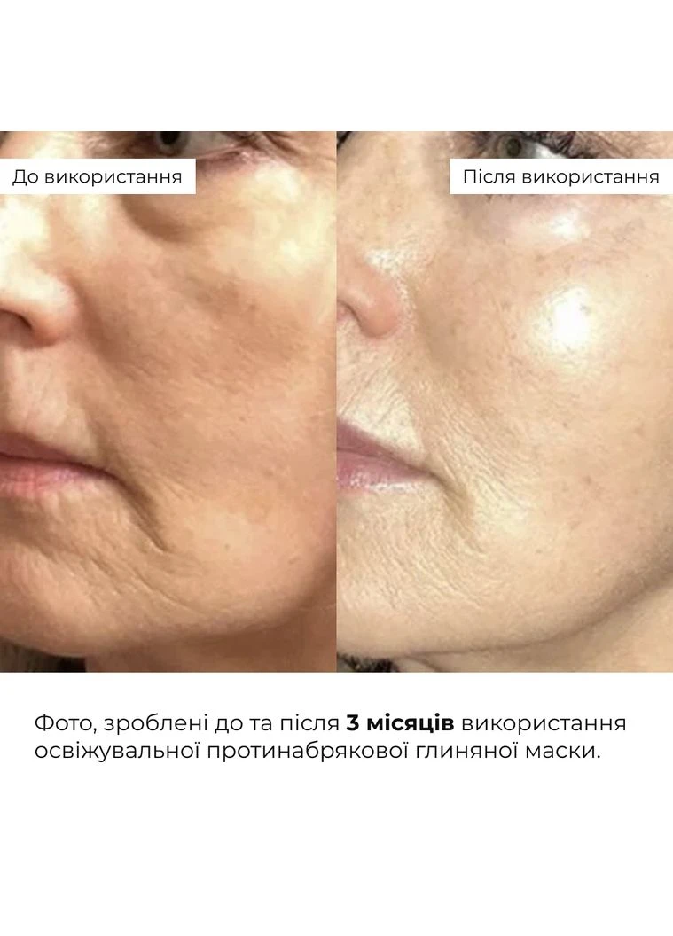 Комплекс для борьбы с отеками и тусклостью кожи Anti-Puffiness & Dullness Skin Care Complex Hillary (387176461)