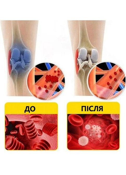 Бандаж на коленный сустав из полыни. XL/40-50см. 2шт. Эластичный. Белый. Согревально-Лечебный. Бандаж колена Bd pol_01 (307288248)