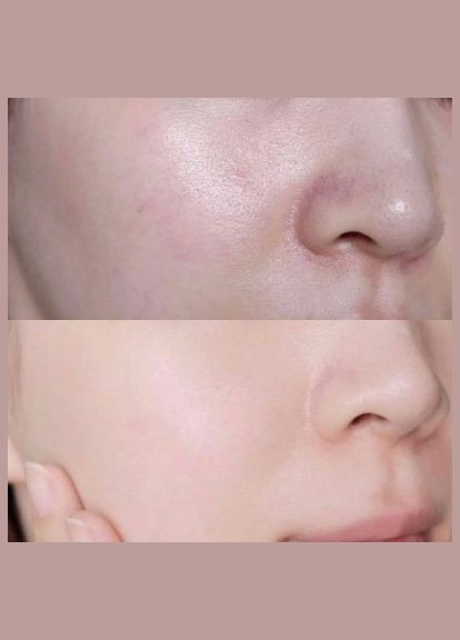 Сыворотка для лица с центеллой и гиалур. кислоты Madagascar Centella Hyalu-Cica Blue Serum, 30 мл SKIN1004 (332052487)