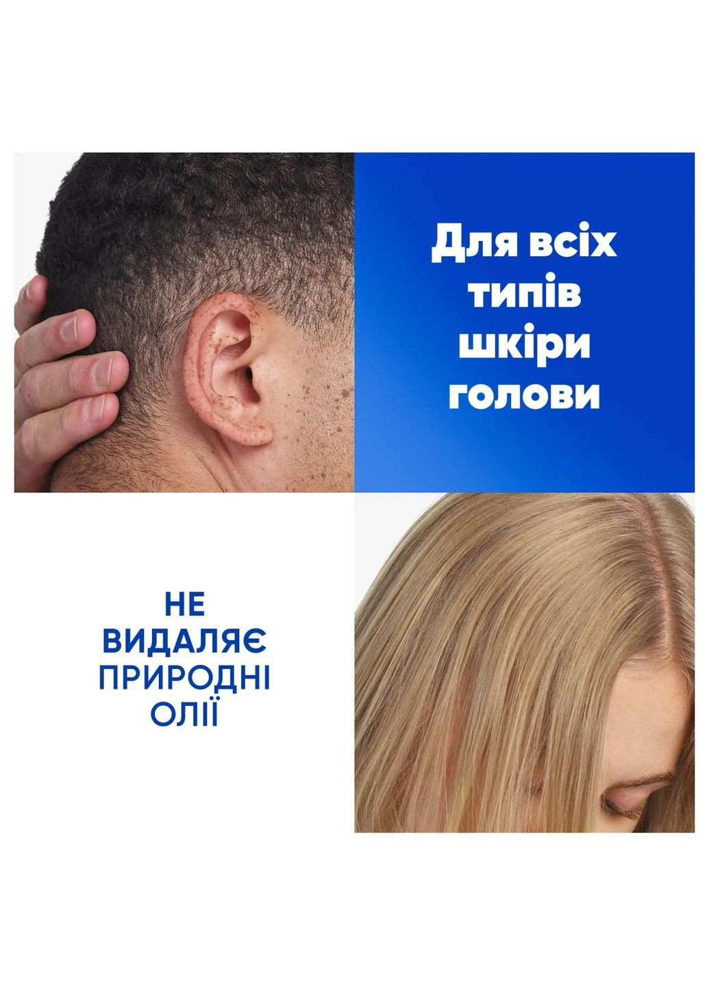 Шампунь проти лупи Head & Shoulders Для чутливої шкіри, 400 мл Head&Shoulders (332944075)