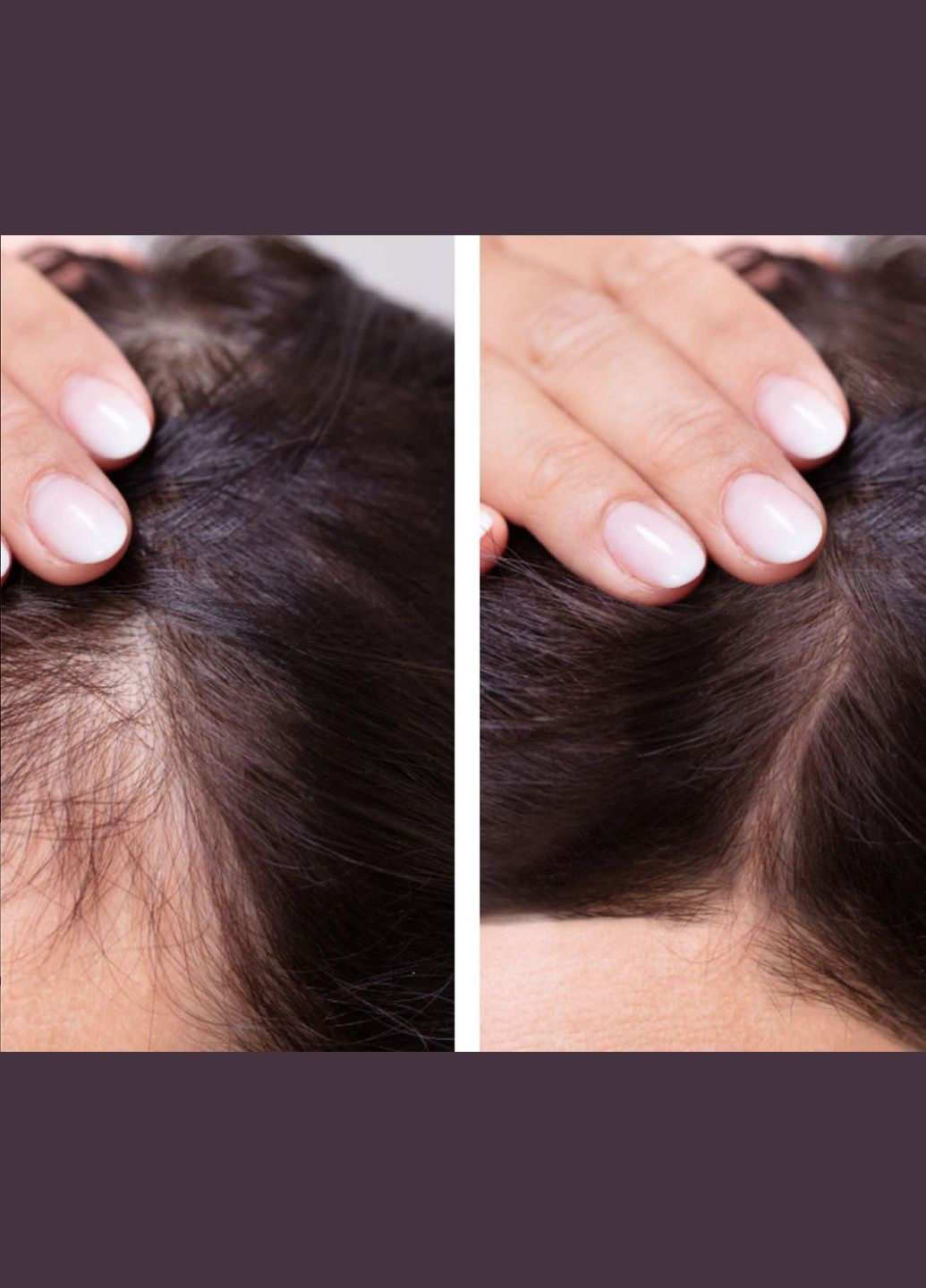 Сыворотка от выпадения волос, смягчение, восстановление поврежденных, от алопеции, флакон 40 мл, 1 шт No Brand (337992350)