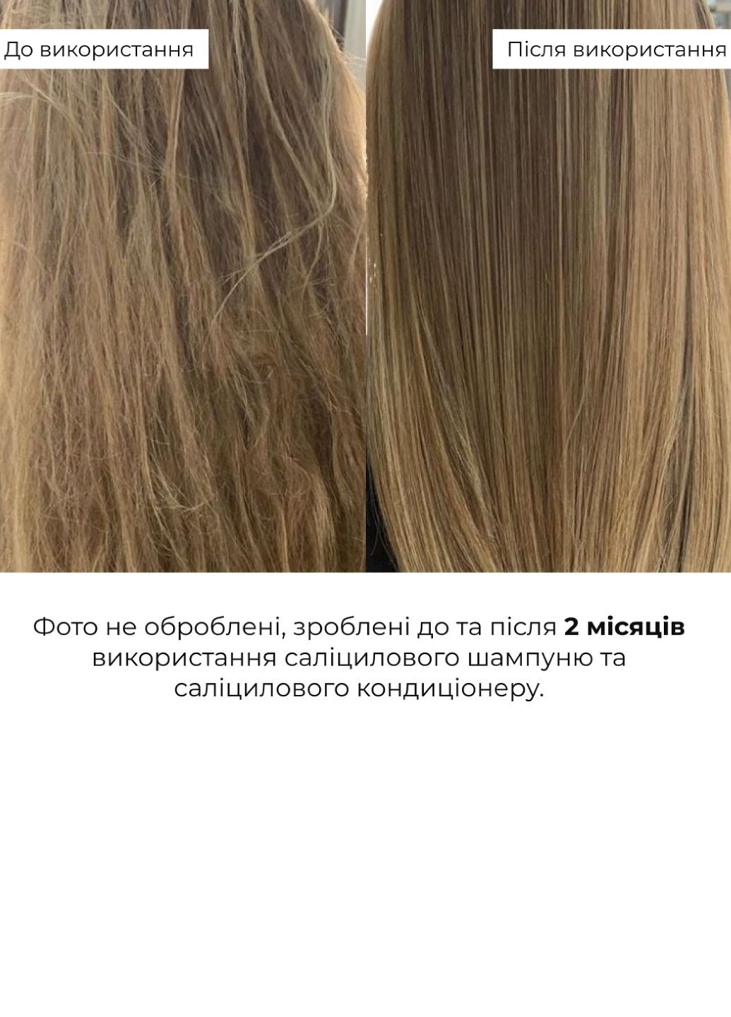 Комплект для глубокой очистки и восстановления волос и кожи головы Deep Cleanse & Hair Restoration Set Hillary (359378427)