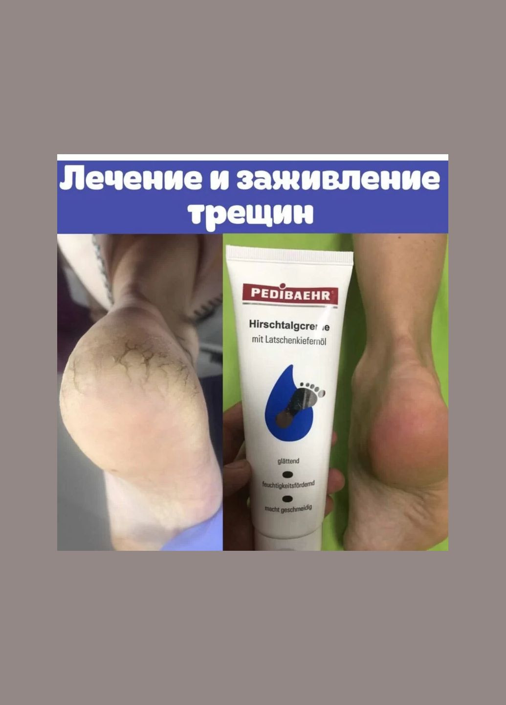 КРЕМ ЗІ 100%-НИМ ОЛЕНІМ ЖИРОМ ДЛЯ НІГ 125МЛ DEER TALLOW CREAM PEDIBAEHR (339668932)