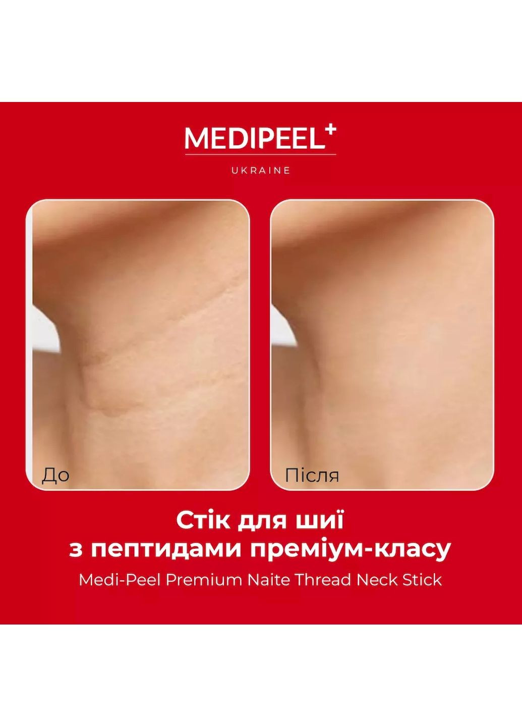 Пептидный стик PREMIUM NAITE THREAD NECK STICK омолаживающий для шеи и декольте, 20 г Medi Peel (297582095)