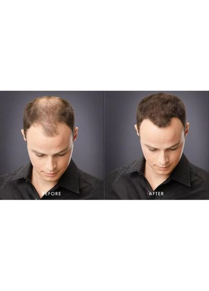 Кератинова пудра для корекції проблемних зон (залисин) 27,5 г Темно-коричневий (Dark Brown) Toppik (302450979)