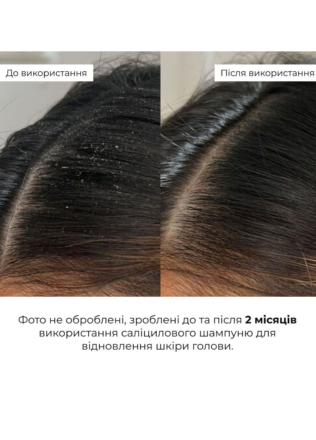 Комплект для глубокой очистки и восстановления волос и кожи головы Deep Cleanse & Hair Restoration Set Hillary (359378427)