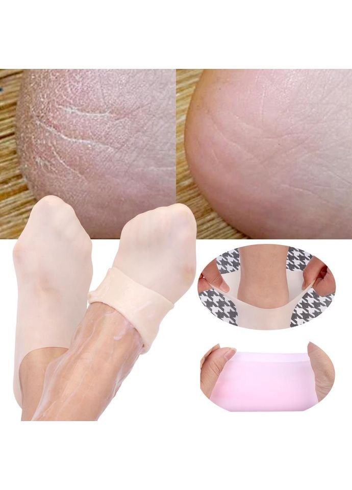 Бежеві шкарпетки для сухих ніг, що потріскалися, зволожуючі гелеві масажні, тілесний колір, 2 пари в наборі (352502242)