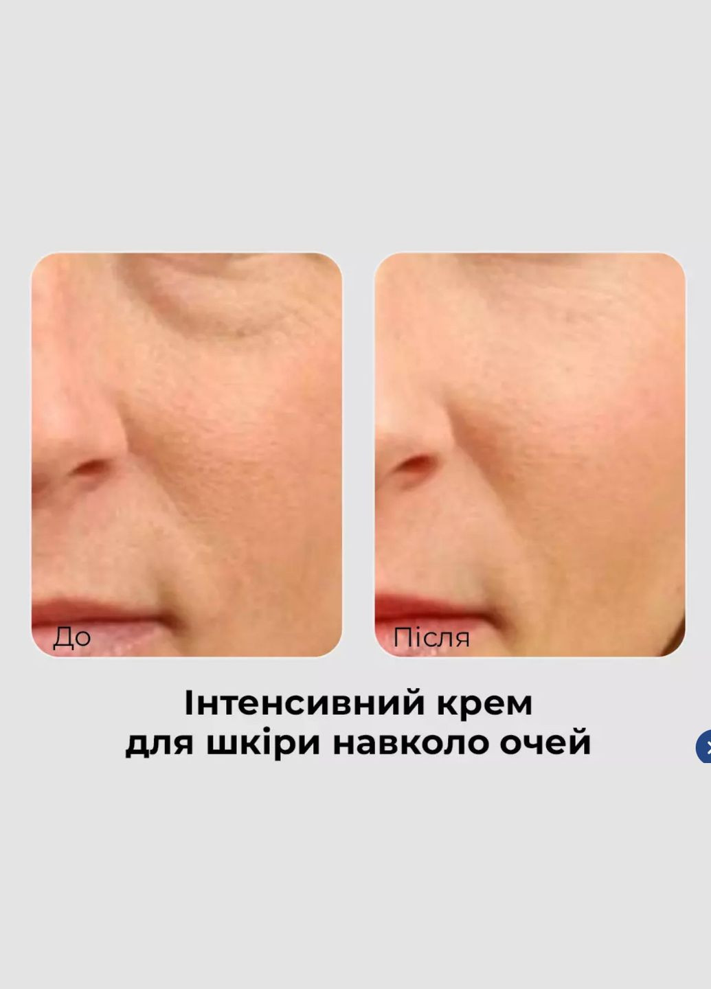 Medi-Peel Антивозрастной крем для век MEDI PEEL PHYTO EXOSOME PDRN LIFTING SHOT EYE CREAM с фито-экзосомами 40мл (5065) — Крем, Южная Корея (323149800)