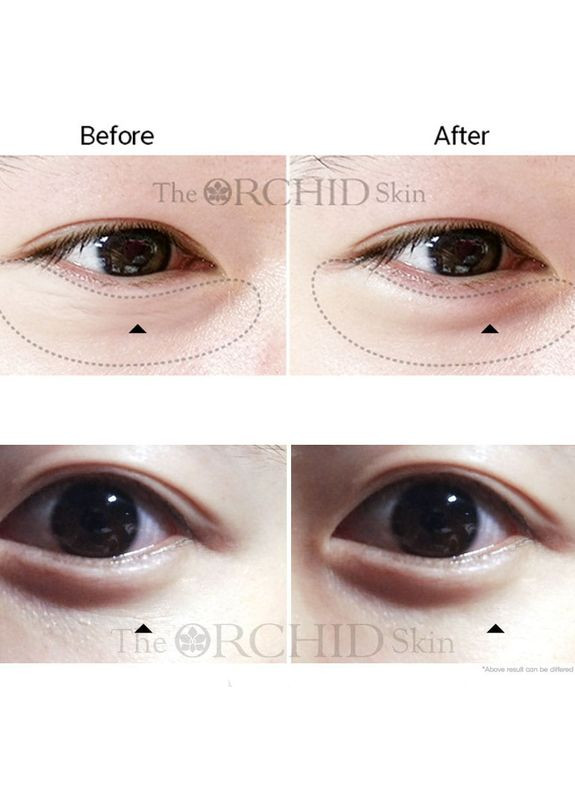 Еластик-патчі проти зморщок під очима Elastic Under Youth Eye Patch 2,3 г The Orchid Skin (317169604)