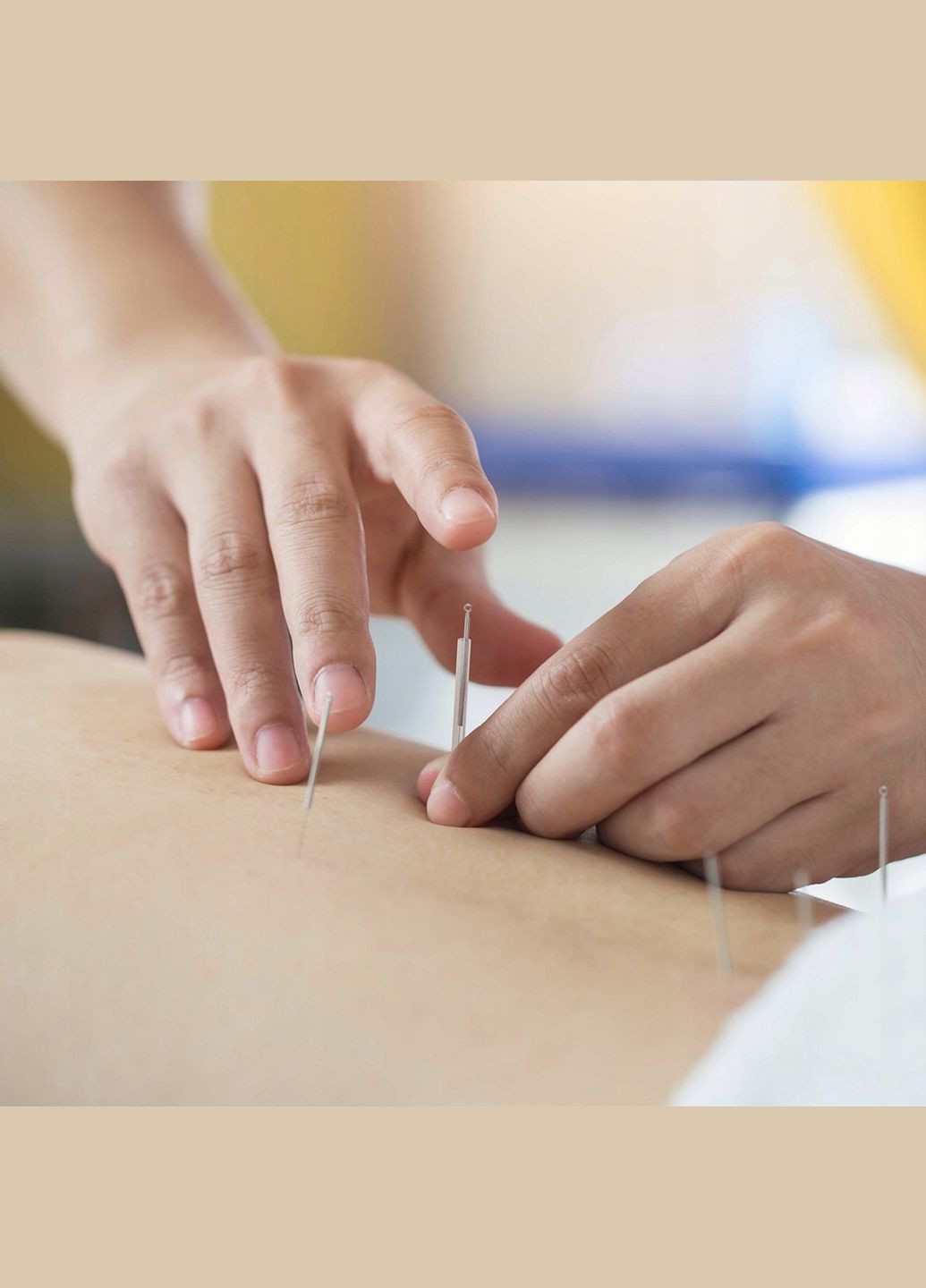 Голки акупунктурні 0.25 х 15 мм з направляючою 100 шт (P-5907739318923) 4FIZJO (301733269)