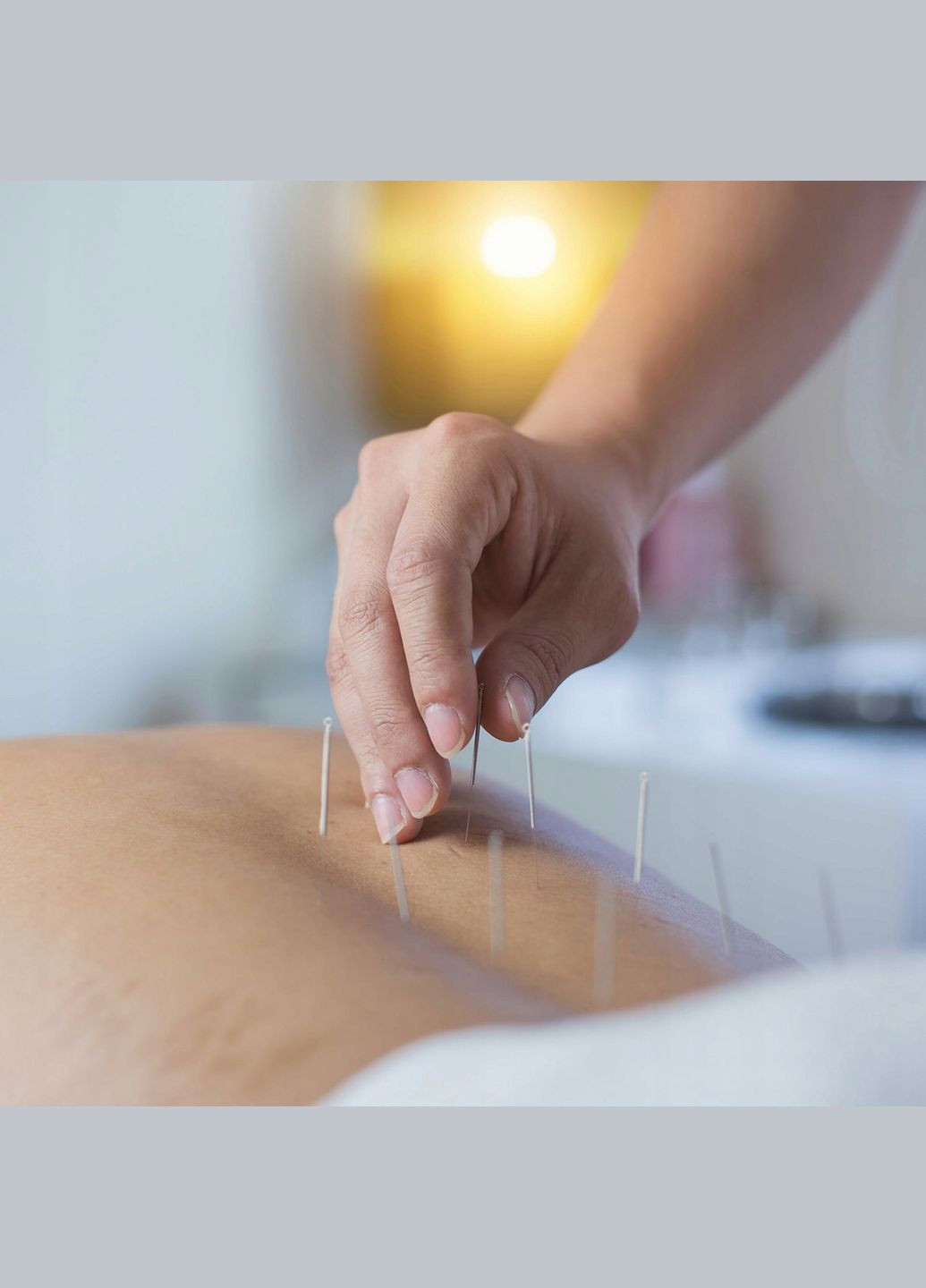 Иглы акупунктурные 0.3 х 75 мм с направляющей 100 шт (P-5907739318961) 4FIZJO (301733261)