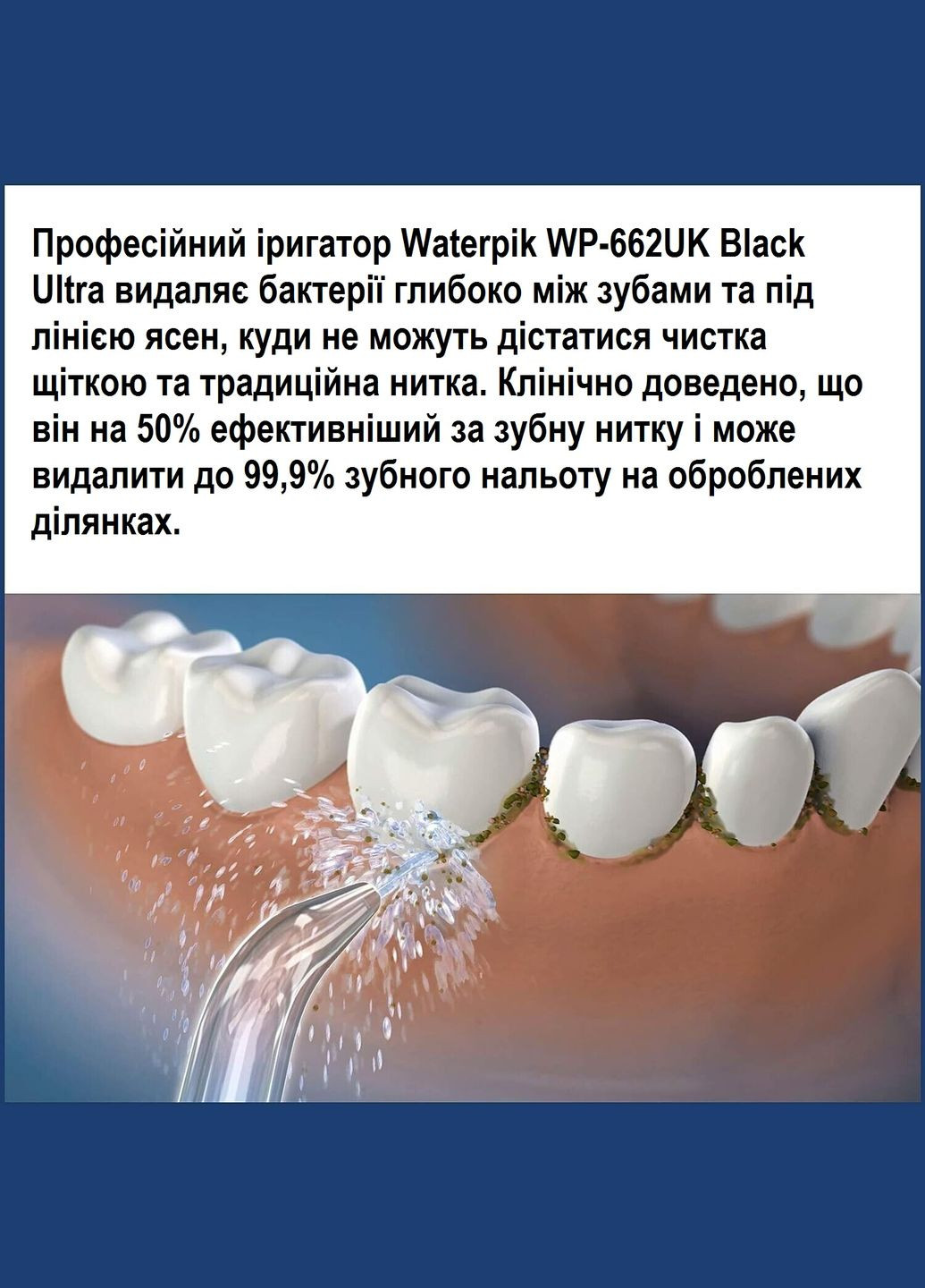 Стаціонарний іригатор WP662UK Ultra Professional Water Flosser Black без коробки Waterpik (286422246)