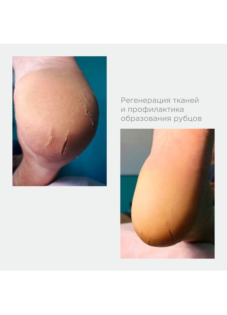 МАСЛО ДЛЯ ШКІРИ РЕГЕНЕРУВАЛЬНІ SCINIE GOLD RUSH 30 МЛ Staleks (373324650)