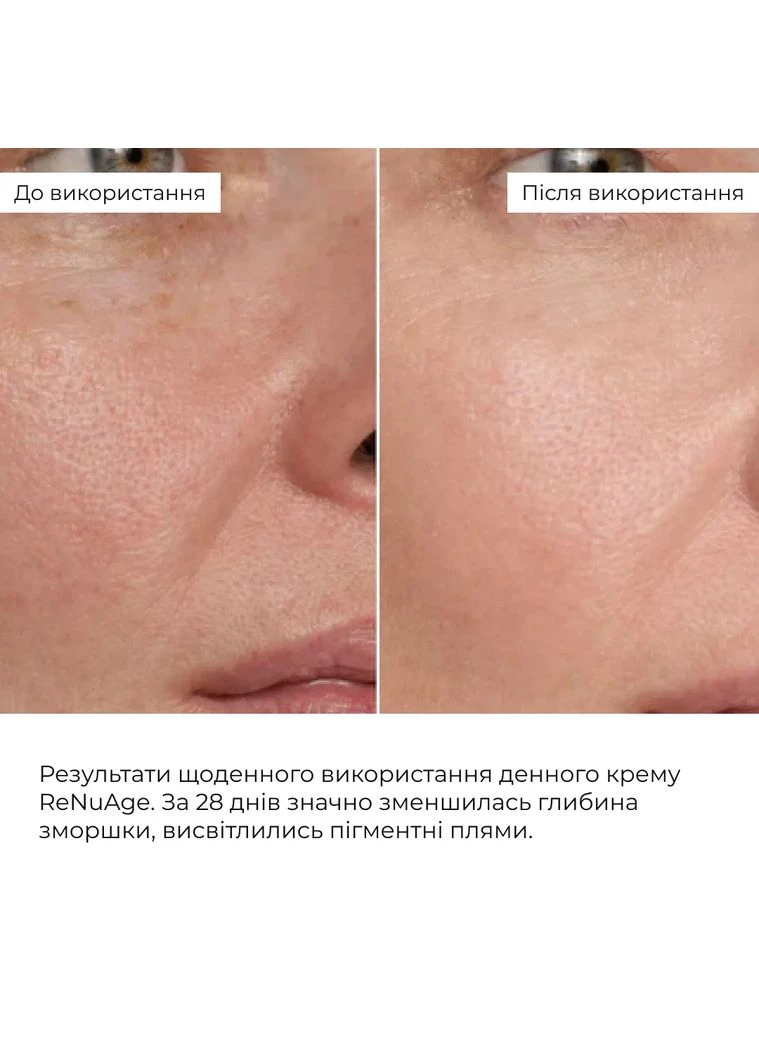 Набір денного ліфтинг-догляду ReNuAge Daytime Lifting Skincare Set Hillary (387353484)