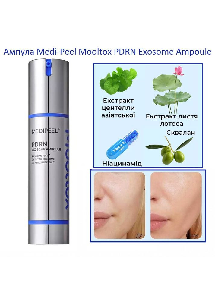 Сыр с полинуклеотидами для эластичности кожной меди-крути. Medi-Peel (358499890)