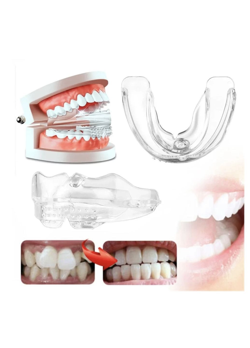 Стоматологический ортодонт. корректор для выпрямления зубов (силиконовые брекеты-капы) 3 шт набор No Brand (369161035)