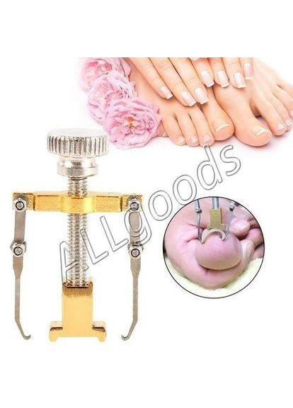 Інструмент для корекції врослого нігтів A.G. (299770148)