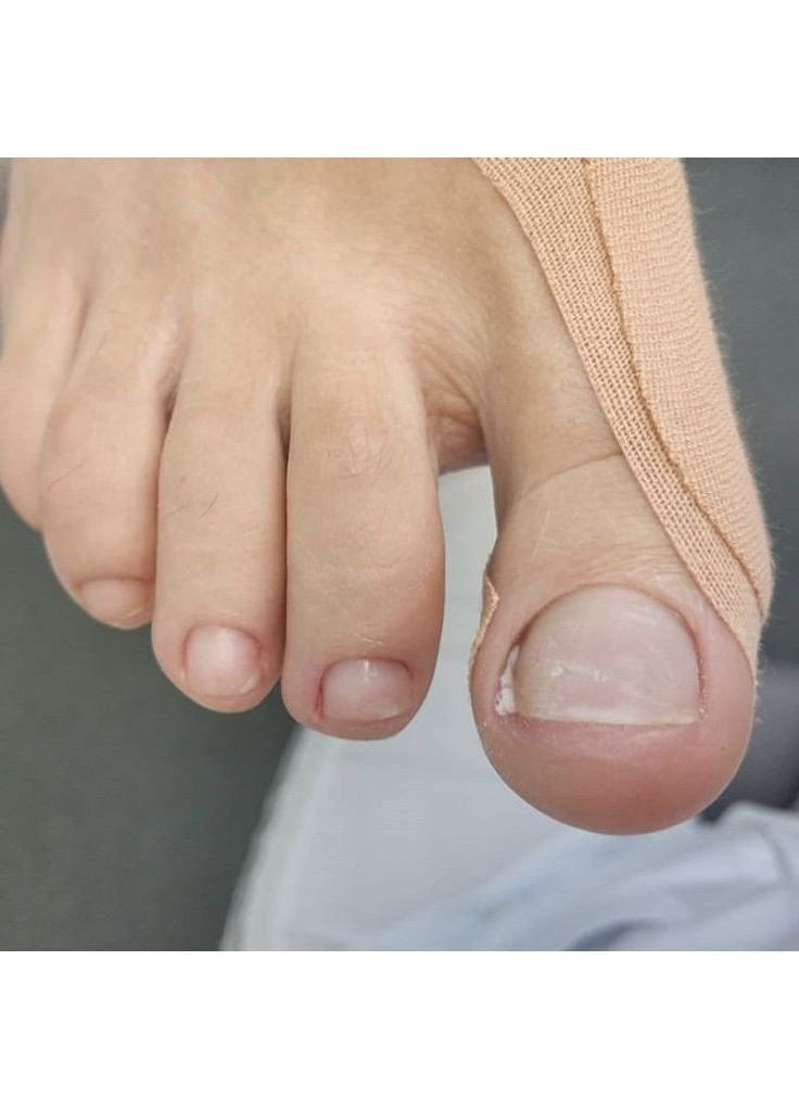 Кінезіо тейп 5см*5м( ) No Brand (369135061)