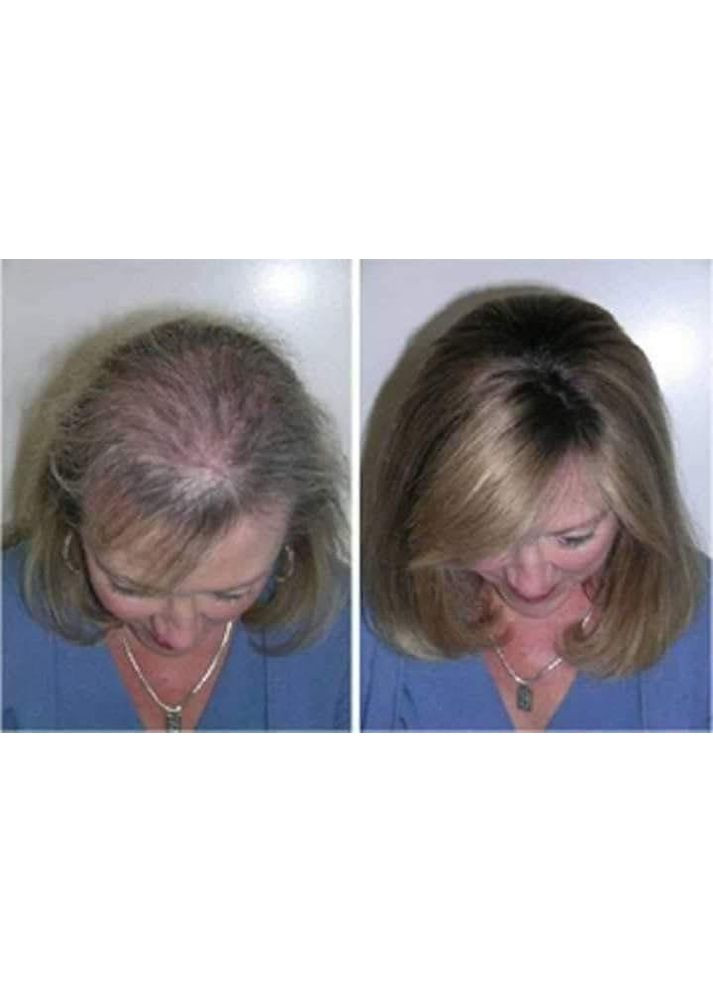 Маска против выпадения волос. Срок 4 J'erelia (315818305)