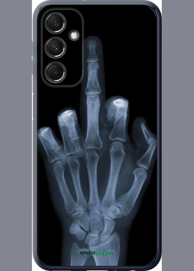 Чехол на Samsung Galaxy M34 5G Рука через рентген "1007u-3141-70447" Endorphone (360623615)