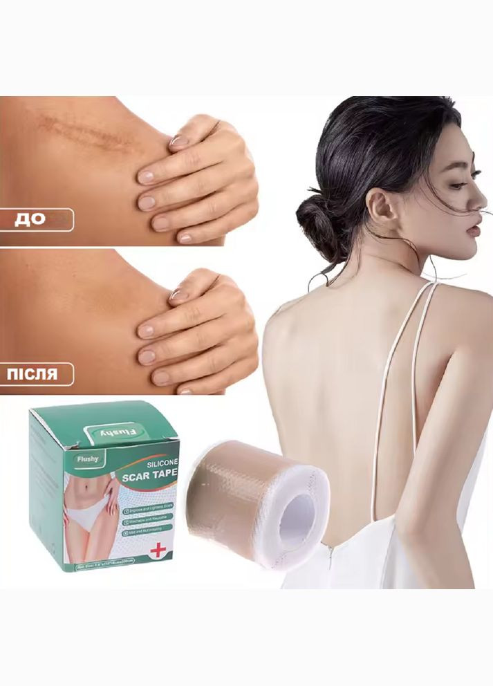 Медицинский силиконовый пластырь для заживления рубцов после операции, при ожогах и растяжках 4×150 см No Brand (337169225)