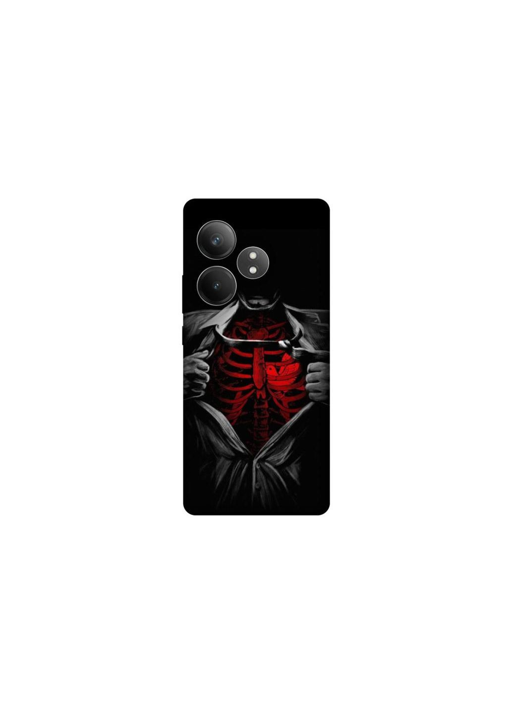 Чохол на Realme GT Neo 6 Skeleton Heart Frontalka (353322013)