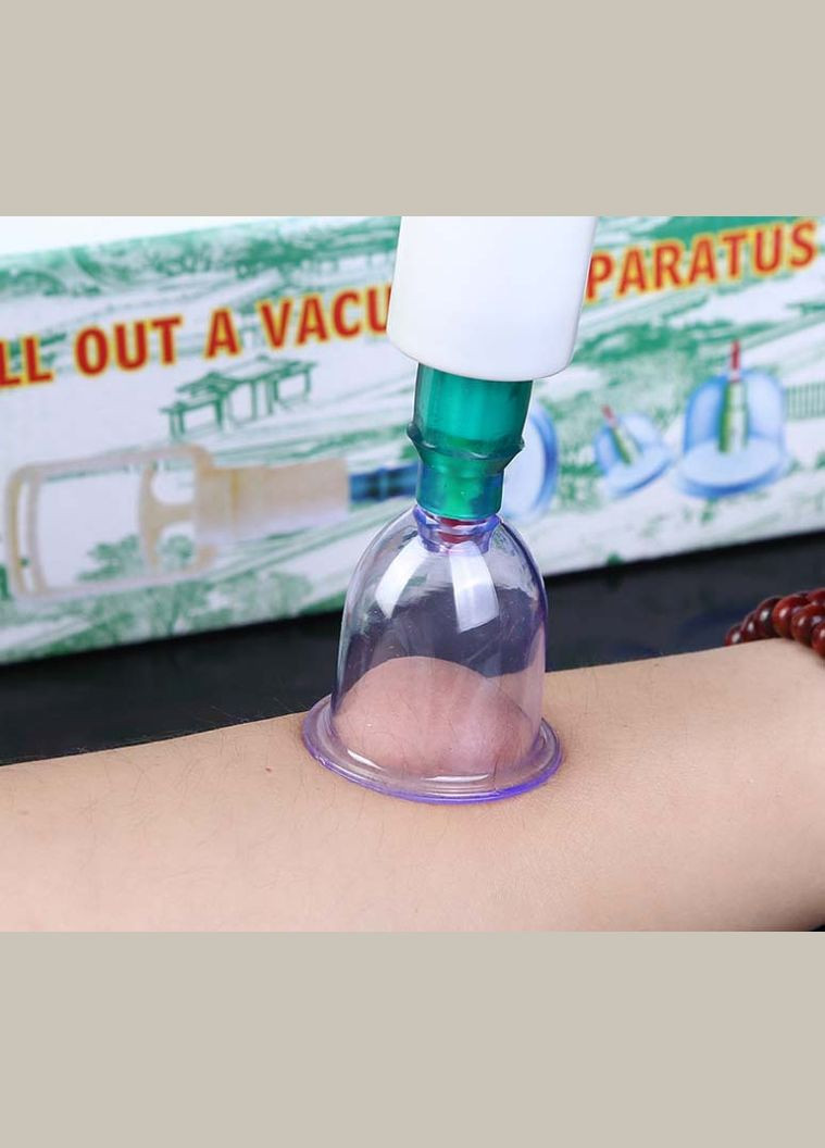 Набір масажних банок 12 штук із вакуумним пістолетом No Brand (370957706)