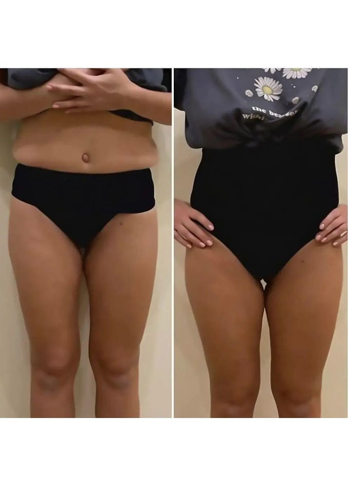 Соблазнительные утягивающие коррекционные стринги ромб, Женские трусики-стринги для коррекции фигуры No Brand утягуючі корекційні стрінги ромб бежевий (360428905)