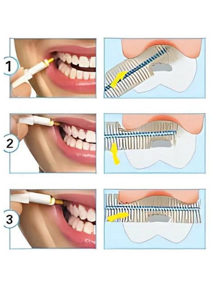 Набір міжзубних йоржів Extrafino 1.1 мм 6 шт. Interdental extrafino Deliplus (307364257)
