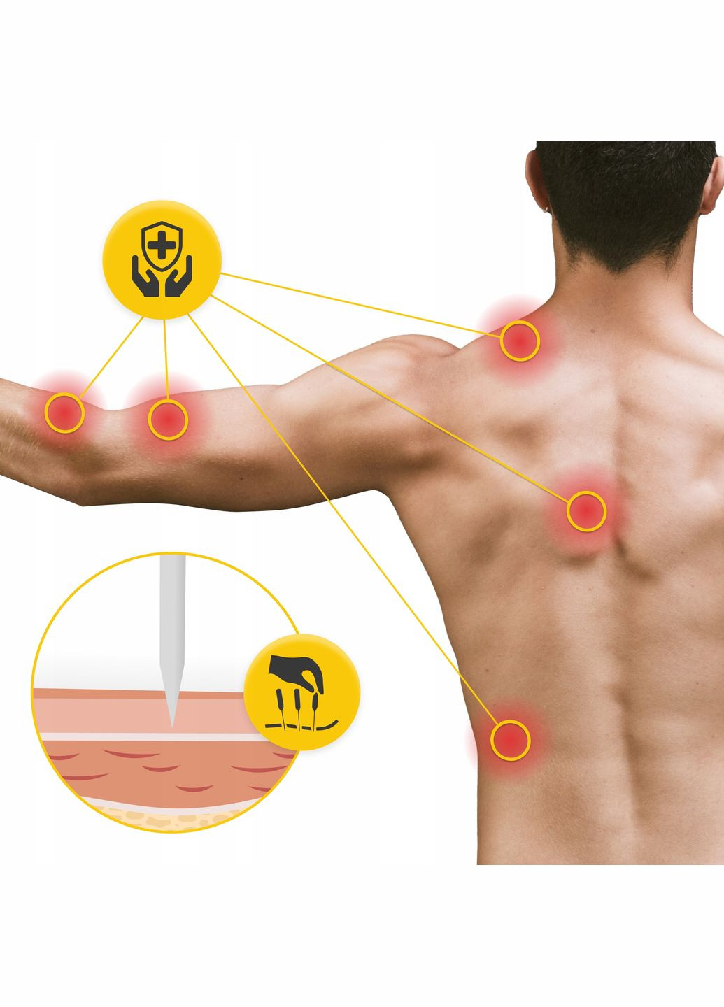 Иглы акупунктурные 0.3 х 50 мм с направляющей 100 шт () 4FIZJO P-5907739318954 (341529037)