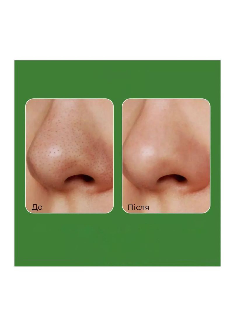 Пілінг-маска з мікроголками для проблемної шкіри EGF Peel Tox, 70 г Medi-Peel (352477388)