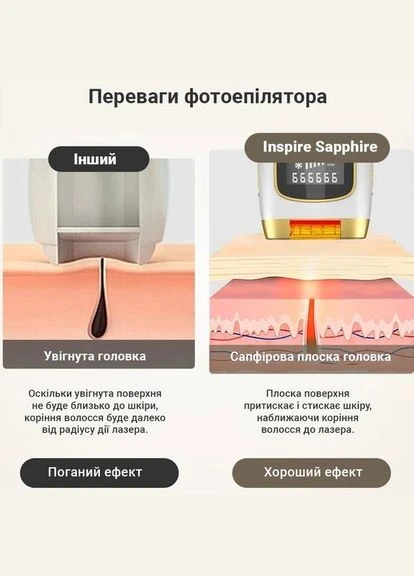 Фотоэпилятор Sapphire XM-L011Bk Inspire (385676464)