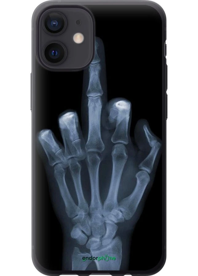 Чехол на iPhone 12 Mini Рука через рентген "1007u-2071-70447" Endorphone (360623979)