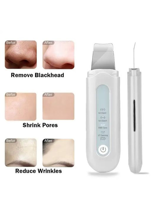 Скрабер портативный ультразвуковой для чистки лица с EMS и ионизацией Beauty Effect WAU-55 Beauty Face (302395787)