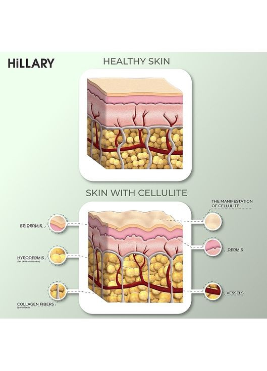 Антицелюлітні обгортання з розігрівальним ефектом Anti-cellulite Bandage Warming Effect 100g (1066812-31020512) Hillary (368654673)