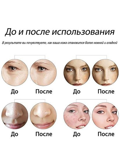 Мезороллер для лица Roller Дермароллер Улучшает Кровообращение Кожи (600238) Clefers (300694485)