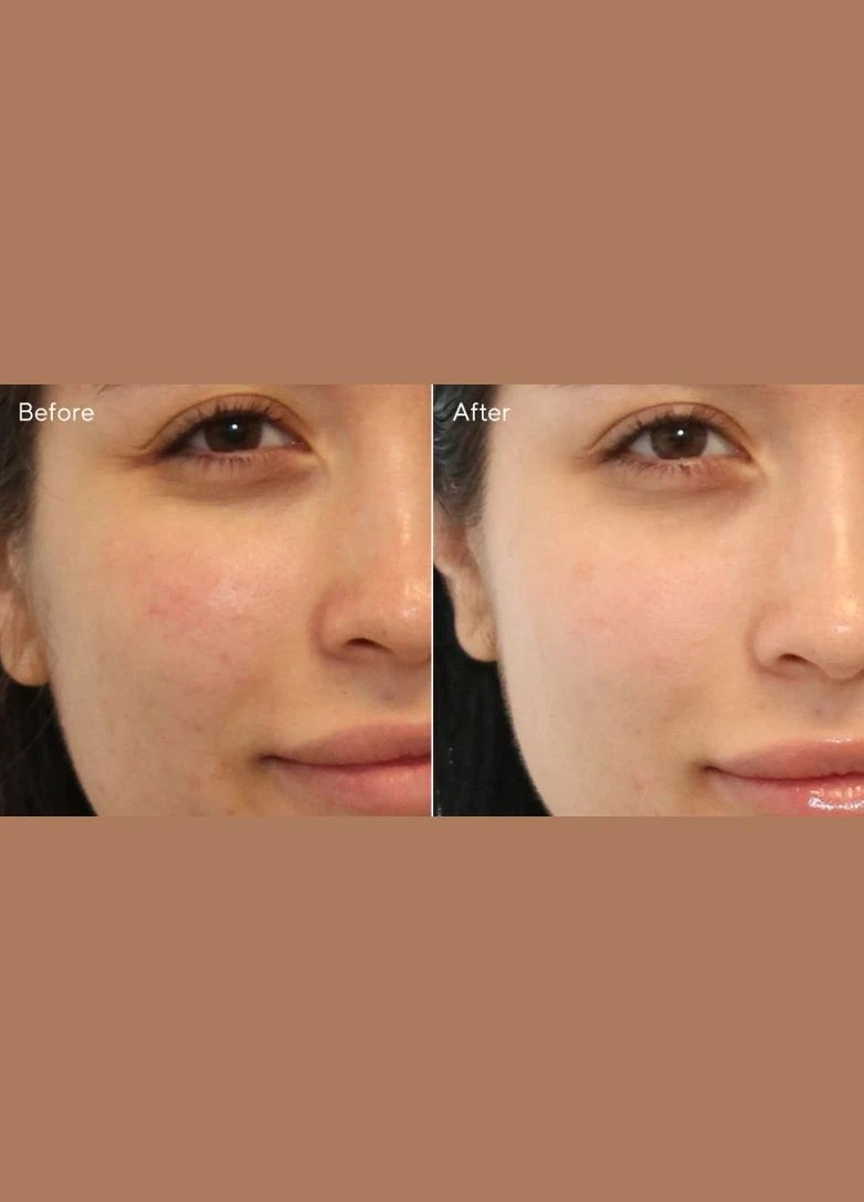 Средство для умывания против прыщей Acne Control Clarifying с салициловой килотой и экстрактом зелёного чая Made in USA 45 мл Murad (286422242)