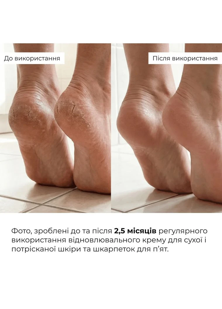 Набір для відновлення сухої та потрісканої шкіри стоп Dry & Cracked Foot Skin Repair Set Hillary (387355397)